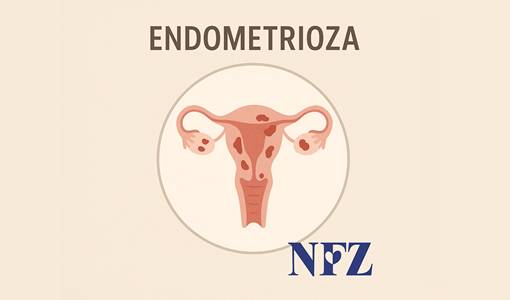 Leczenie endometriozy finansowane przez NFZ
